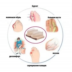 Для тех, у кого растёт "шишка" на сгибе стопы. Отделитель большого пальца ___KRY047/049 (2767)